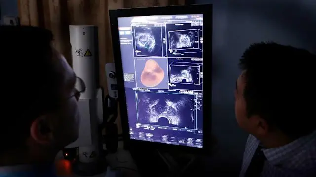 Joe Biden’s Prostate Cancer Diagnosis: What Men Need to Know About Prostate Cancer Signs and Symptoms 2 Joe Biden’s Prostate Cancer Diagnosis: What Men Need to Know About Prostate Cancer Signs and Symptoms