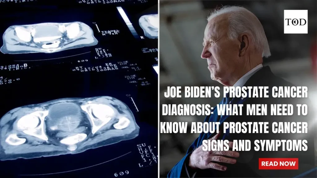 Joe Biden’s Prostate Cancer Diagnosis: What Men Need to Know About Prostate Cancer Signs and Symptoms