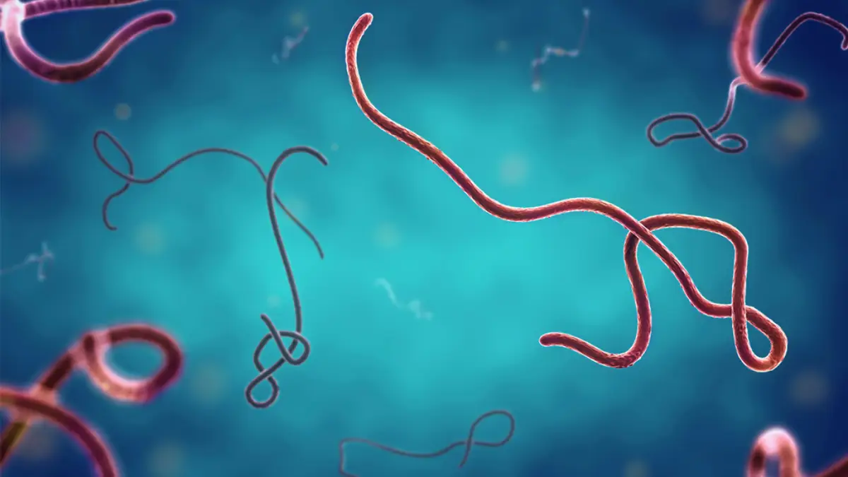 image - Times of Dubai Visa suspension amidst ebola virus times of dubai